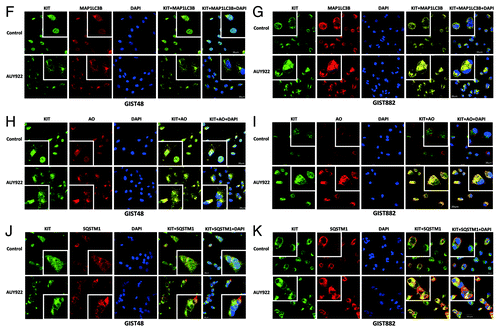 Figure 4F–K. Cell lysates were extracted and analyzed by immunoblotting against BECN1, ATG5 and KIT. GIST48 and GIST882 cells were treated with 1 μM AUY922 for 1 h and then stained with KIT, MAP1LC3B (F and G), AO (H and I) or SQSTM1 (J and K). After immunostaining, cells were visualized by confocal microscopy and images were acquired through the Cy2, Rhodamine or DAPI channels (600×). The data were representative ones of 5 fields/pictures of each sample. The inserted figure in the corner showed magnified (1500×) and representative cells of each image.