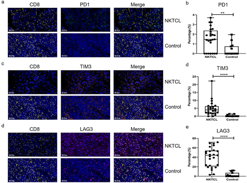 Figure 6. Upregulated IRs in tumor microenvironment of NKTCL. Representative images (a,c,d) and pooled data (b,d,e) of PD1, TIM3 and LAG3 expression in CD8+ T cells in both NKTCL and reactive hyperplastic lymphadenopathies (indicated as Control).