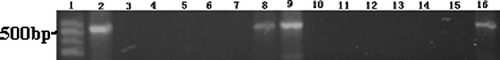 Figure 2 A typical result from duplicate experiments showing the PCR of β-actin cDNA derived from HeLa cells in the presence of fullerol (lane 3 ∼ 9) or TMA C60 (lane 10 ∼ 16). Lane 1: standard DNA marker; lane 2: without fullerene derivative; lane 3,10: 1 mM; lane 4,11: 0.1 mM; lane 5,12: 0.06 mM; lane 6,13: 0.03 mM; lane 7,14: 0.01 mM; lane 8,15: 0.005 mM; lane 9,16: 0.001 mM.