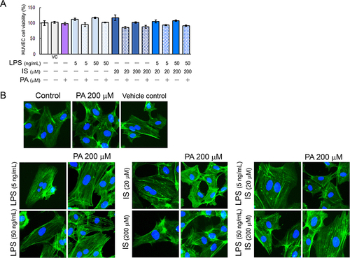 Figure 1 (A) The viability of HUVEC cells stimulated for 20 h with PA alone or in combination with LPS and IS relative to the negative control (untreated cells) or vehicle control (VC; PA solvent). The results are the mean ± SD of three repeats performed in eight wells each. (B) Representative images of HUVECs morphology after treatment with PA alone and combined with LPS and IS. The actin cytoskeleton of endothelial cells was stained with phalloidin-FITC and the cell’s nuclei with DAPI. Fluorescence microscope, magnification 400x.