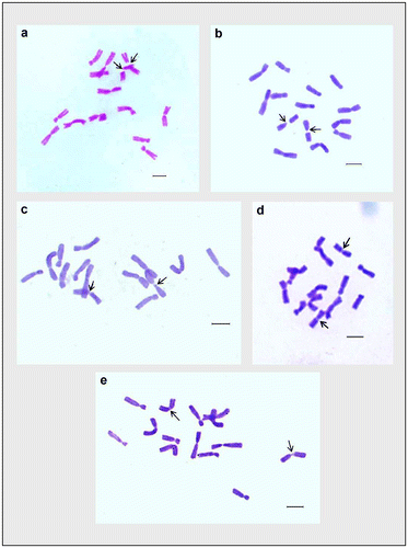 Figure 3. Giemsa stained somatic metaphase plates of different cultivars of Lens culinaris. (a) EC-267590; (b) Macro-Uttar Pradesh; (c) EC-267569-A; (d) EC-78461; (e) EC-78473. Arrows indicate chromosomes with two constrictions. Bar = 5 μm.