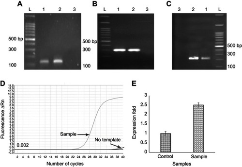 Figure S1 Agarose Gel Electrophoresis for the detection of the femA gene (132 bp) (A) and mecA gene (297 bp) (B) hla gene (209 bp) (C) in MRSA clinical isolate by PCR. Lanes: L, molecular marker (100 bp DNA ladder); 1, Staphylococcus aureus ATCC 3591 as positive control; 2, MRSA clinical isolate; 3, E. coli ATCC 25922 as negative control. The Real Time PCR amplification curve (D) and gene expression for hla gene (E) in which gmK gene was used as internal control