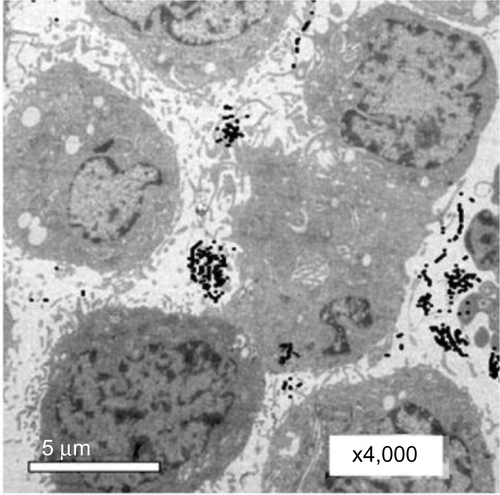 Figure S1 TEM images of Hep-2 cells incubated with 0.1nmol/L EGFRmAb-AuNRs for 30 minutes. EGFRmAb-AuNRs accumulated on the membrane of Hep-2 cells.Abbreviations: AuNR, gold nanorod; EGFR, epidermal growth factor receptor; EGFRmAb, anti-EGFR monoclonal antibody; TEM, transmission electron microscope.