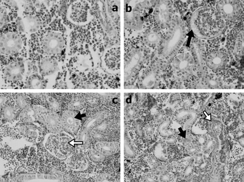 Figure 2. Normal architecture of kidney section from the control group (a). Glomerular edema and hyperemia (arrow in b). Hyaline casts (black arrows in c and d) and glomerulitis (white arrow in c). Interstitial fibrosis around the tubule (white arrow in d) HE.