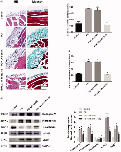 Figure 2. Overexpression of miR-15a-5p can alleviate PF caused by PD. (A) Hematoxylin–eosin (HE) and Masson staining are shown for peritoneal observation. (B) Expression of collagen IV, fibronectin, α-SMA, E-cadherin, and VEGF in the control group, PD group, PD + LV3-shNC group, and PD + LV3-miR-15a-5p group, as detected by western blot. GAPDH was used as an internal control. Expression levels of proteins were normalized by the control group. *p < 0.05 versus control, #p < 0.05 versus PD.