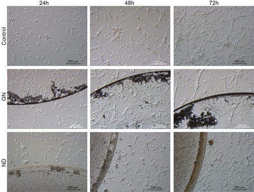 Figure 5 Morphological characterization of the U-87 MG human glioblastoma grade IV cell line, seeded on GN and ND nanofilms after 24 hours, 48 hours, and 72 hours.