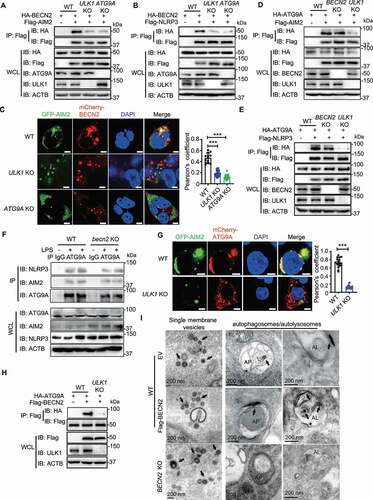 Figure 5. The interaction between BECN2 and inflammasome components requires ULK1 and ATG9A. (A and B) WT, ULK1 KO, and ATG9A KO HEK293T were co-transfected with HA-tagged BECN2 and Flag-tagged AIM2 (A) or NLRP3 (B), the cell lysates were immunoprecipitated with anti-Flag beads and then immunoblotted using indicated antibodies. (C) WT, ULK1 KO and ATG9A KO HEK293T cells co-transfected with GFP-AIM2 and mCherry-BECN2 were fixed with 4% (wt/vol) paraformaldehyde. Pearson’s correlation coefficient for colocalization was analyzed using Image J Coloc 2. Graph is plotted as mean ± s.e.m. (at least 30 cells were analyzed per condition). Representative images showing the colocalization were obtained using confocal microscopy. Scale bar: 5 μm. (D and E) WT, BECN2 KO, and ULK1 KO HEK293T were co-transfected with HA-tagged ATG9A and Flag-tagged AIM2 (D) or NLRP3 (E), the cell lysates were immunoprecipitated with anti-Flag beads and then immunoblotted using indicated antibodies. (F) WT and Becn2 KO BMDMs cells were left untreated or stimulated with LPS (200 ng/ml) for 3 h, the cell lysates were then immunoprecipitated using ATG9A antibodies, followed by immunoblotting with indicated antibodies. (G) WT and ULK1 KO HEK293T cells co-transfected with GFP-AIM2 and mCherry-ATG9A were fixed with 4% (wt/vol) paraformaldehyde. Pearson’s correlation coefficient for colocalization was analyzed using Image J Coloc 2. Graph represents mean ± s.e.m. (at least 30 cells were analyzed per condition). Representative images showing the colocalization were obtained using confocal microscopy. Scale bar: 5 μm. (H) WT and ULK1 KO HEK293T were co-transfected with Flag-tagged BECN2 and HA-tagged ATG9A, the cell lysates were immunoprecipitated with anti-Flag beads and then immunoblotted using indicated antibodies. Data are representative of at least three independent experiments. (I) WT and BECN2 KO 293T cells were transfected with AIM2-APEX2 encoding plasmid alone or along with Flag-BECN2. Representative EM images of cells expressing AIM2-APEX2 were processed in parallel under identical conditions. Black arrow indicates the AIM2 location. AP, autophagosome or amphisome; AL, autolysosome. Statistical differences between WT and KO groups were calculated using Student’s unpaired t-test (G) or 1-way ANOVA with Dunnett’s multiple comparison test (C). ***P < 0.001.