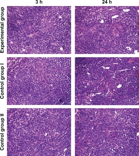 Figure 4 H&E staining of tumor section from the experimental group (intravenous injection of QD800-EGFR Ab probe), control group I (intravenous injection of QD800), and control group II (preinjection of EGFR monoclonal antibody 24 hours before QD800-EGFR Ab probe injection) of BcaCD885 squamous cell carcinoma 3 and 24 hours after probe injection (×200).Abbreviations: Ab, antibodies; BcaCD885, human buccal squamous cell carcinoma cell line; EGFR, epidermal growth factor receptor; H&E, hematoxylin and eosin; QD800, quantum dots with a maximal emission wavelength of 800 nm.