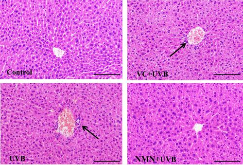 Figure 1 Photomicrograph of liver paraffin sections stain with (H&E). The black bars indicate 200 μm. The black arrows indicate necrotic cells.