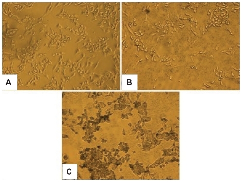 Figure 4 PET/CT fusion and PET sagittal images of two nude rats bearing HNSC xenograft at 1 hour, 4 hours, 20 hours, and 44 hours post tail-vein injection of 64Cu-NS and 64Cu-NS–RGDfK. The arrows are pointing at the tumor.Abbreviations: CT, computed tomography; HNSC, head and neck squamous cell carcinoma; NS, nanoshell; PEG, polyethylene glycol; PET, positron emission tomography; RGDfK, Arg-Gly-Asp-D-Phe-Lys.