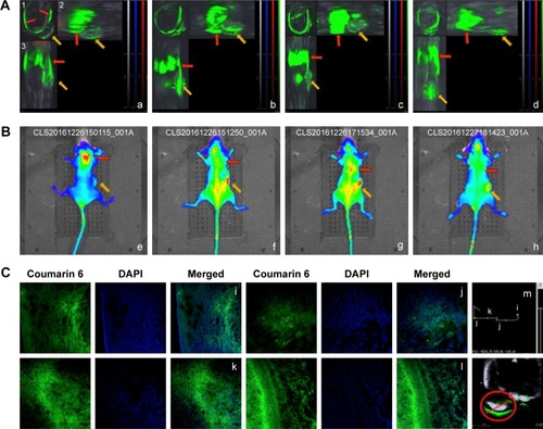 Figure 2 The biodistribution of DiR/coumarin 6-loaded mPEG2000–PDLLA5000 micelle (48 nm) in tumor tissue in a 4T1 tumor-bearing mice.Notes: (A) MSOT image of a 4T1 tumor-bearing mice with 48-nm micelle postinjection at 3.5, 5, 7, and 9 hours (a–d). Each figure can give the front view, side view, and top view slice image (1–3). The red arrow indicates the liver site, and the yellow arrow indicates the tumor side. (B) IVIS in vivo imaging of a 4T1 tumor-bearing mice with 48-nm micelle postinjection at 3.5, 5, 7, and 9 hours (e–h). The red arrow indicates liver sites, and the yellow arrow indicates tumor sites. (C) Ex vivo fluorescence imaging of different tumor sites. The mice were sacrificed at 5 hours after injection. The microscope results are placed in an order from the center to the border of the tumor (i–l). The move path when using microscope to observe the tumor slice and MSOT result (m). The red circle indicates the tumor site, and the red line indicates the imaging path of fluorescence microscopy moves.Abbreviations: DAPI, 4′,6-diamidino-2-phenylindole; DiR, 1,1′-dioctadecyl-3,3,3′,3′-tetramethylindotricarbocyanine iodide; MSOT, multispectral optoacoustic tomography.