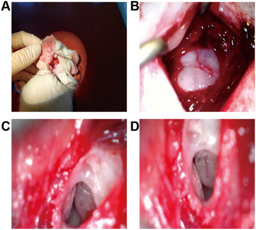Figure 1 Surgical procedure for the implantation in guinea pigs: (A) Posterior incision behind the left ear; (B) Mastoid exposure; (C) Part of the bone was removed, the round window niche was exposed followed by basal turn cochleostomy; (D) Analog electrode array insertion.