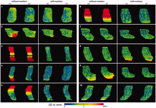 Figure 2. Anterior view of the local surface distance variation (SD) over the five observers projected on the median surface of the 10 patients in the series without and with markers. Column (a) the original series (b) the repeated series.