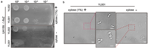 Figure 3.  Growth phenotypes of FtsZ depletion in S. mutans. (a) Growth of different dilutions of strain YL001 and YL002 on BHI plate with or without xylose. (b) The cell morphology change after FtsZ depletion were analyzed by live cell microscope. Red dot line box marked the enlarged area. Scale bar: 2 μm.