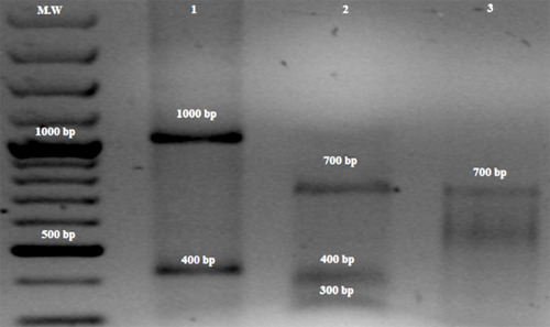 Figure 2 PCR-RFLP based detection of mutations A2142G and A2143G in 1400 kb amplicon of 23S rRNA gene of H. pylori with BsaI and MboII restriction enzymes, respectively. Lane 1 shows the new MboII RFLP pattern, ie, approximately 1000bp and 400 bp fragments appears in the presence of A1761G mutation and sequencing also confirmed this mutation (see Figure 3); Lane 2 shows the clarithromycin resistant restriction profile with BsaI, ie, 700bp, 400bp and 300bp fragments indicate the presence of A2143G mutation; Lane 3 shows the clarithromycin resistant profile with MboII, ie, 710bp and 690 fragments indicate the presence of A2142G mutation, M.W, 100bp molecular weight marker.