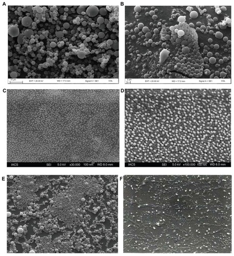 Figure 2 FESEM photographs of formulations. (A) Formulation S1 prepared at 15,000 rpm shows that the particles were of micrometer sizes. (B) Formulation S2 prepared at 15,000 rpm shows that the particles were in micron range. (C) Formulation S3 prepared at 16,000 rpm shows that the particles were in nanometer range. (D) Formulation S4 prepared at 16,000 rpm shows that the particles were in nanometer range. (E) Formulation S5 prepared at 15,000 rpm shows that the particles were mostly in micrometer range. (F) SEM photograph of the gold nanoparticles shows that the particles were in submicron range with variable sizes.Abbreviations: FESEM, field-emission scanning electron microscopy; SEM, scanning electron microscopy.