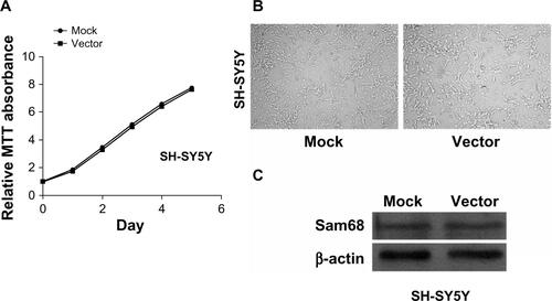 Figure S2 Cell growth and Sam68 expression in SH-SY5Y cells (mock) and vector-infected cells (vector).Notes: (A) The cell growth of mock and vector as determined by MTT assay. (B) Cultured cells under microscope. (C) Western blotting shows the expression level of Sam68 protein.Abbreviations: MTT, 3-(4, 5-dimethyl-2-thiazolyl)-2, 5-diphenyl-2H-tetrazolium bromide; Sam68, Src-associated in mitosis with a molecular weight of 68 Kd.