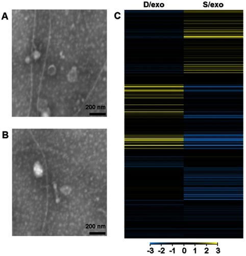 Figure 1 Exosome characterization and miRNA profiling. Representative transmission electron microscopy images of D/exo (A) and S/exo (B), showing the same morphology and a diameter of 20–100 nm (scale bar, 200 nm). (C) Hierarchical cluster analysis of miRNA expression profiles in D/exo with respect to S/exo. Yellow and blue colors stand for a transcript level above and below the median level, respectively.Abbreviations: D/exo, exosomes from docetaxel-resistant cells; S/exo, exosomes from parental sensitive cells.