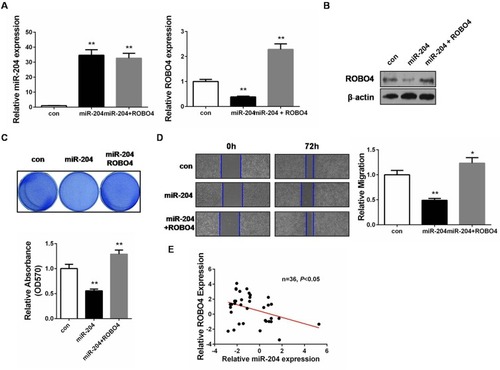 Figure 5 miR-204 mediates a tumor-suppressing role through ROBO4 in bladder cancer. (A) The expressions of miR-204 and ROBO4 in 5637 cells 48hrs after transfection with miR-204 mimics without or with ROBO4 plasmids were measured by qRT-PCR. (B) The expressions of miR-204 and ROBO4 in 5637 cells 48hrs after transfection with miR-204 mimics without or with ROBO4 plasmids were measured by Western blot analysis. (C) Crystal violet staining assay was conducted to evaluate cell proliferation after miR-204 mimics without or with ROBO4 plasmids transfection. The quantitative results were shown in panel below. (D) Cell migration ability was investigated with wound healing assay and the images were taken at 0 and 72hrs after miR-204 mimics without or with ROBO4 plasmids transfection (40×). (E) miR-204 and ROBO4 expression levels exhibited negative correlation. **P<0.01.