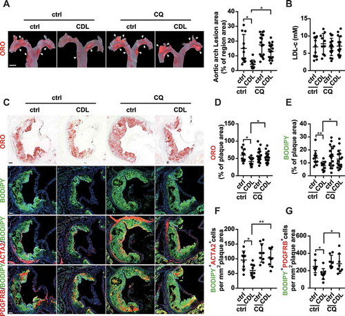 Figure 9. The P2RY12 receptor inhibitor ameliorates VSMC-derived foam cell formation by inducing autophagy in advanced atherosclerosis. apoe-/- mice were given HFD for 8 weeks to induce atherosclerotic lesions and maintained on HFD for another 4 weeks, during which ctrl, CDL or CQ was administered. (A) ORO image of aortic arches obtained from mice in the indicated groups (left). Scale bar: 2 mm. White arrows indicate plaques in the aorta. Lesions were calculated as a percentage of the surface area of the aortic arch (n = 11, 10, 16, and 17, respectively). (B) Serum LDL-c levels in mice in the ctrl, CDL, CQ, or CQ + CDL groups (n = 11, 10, 15, and 15, respectively). (C) Representative images of aortic root sections obtained from ctrl, CDL, CQ, and CQ + CDL groups stained with ORO, ACTA2-BODIPY, or PDGFRB-BODIPY. Scale bar: 20 μm. For fluorescence images, Nuclei were stained with DAPI (blue). The percentage of the plaque area that was occupied by ORO (D) or BODIPY (E) are presented (n = 11, 10, 18, and 17, respectively) among indicated groups. The number of ACTA2+ BODIPY+ cells (F, n = 9 per group) or PDGFRB+ BODIPY+ cells (G, n = 8, 9, 7 and 8, respectively) per mm2 of plaques in the indicated groups is presented. All data are presented as the mean ± SEM from 3 to 5 independent experiments. *, P < 0.05; **, P < 0.01