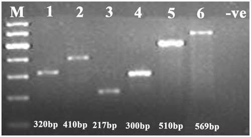 Figure 1. Gel image showing the amplification result of mtDNA control region from the DNA extracted from bird samples using primer FLCF1 + FLCR1 (lane 1); FLCF1 + FLCR2 (lane 2); FLCF2 + FLCR1 (lane 3); FLCF2 + FLCR2 (lane 4); FLCF4 + FLCR3 (lane 5); FLCF3 + FLCR4 (lane 6).