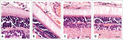 Figure 2. The morphology of the retina of 4-month-old rats. (A) In Wistar rats, RPE cells had a prismatic shape with oval nuclei (black arrows), normal retinal layers. (B) In OXYS rats, stasis, and sludge of the blood cells are visible in capillaries of the choroid, RPE cells were flat, with a variable size and shape of the nuclei (black arrows), pyknosis of nuclei of neurosensory cells. (C and D) In OXYS rats: treatment with SkQ1 prevented anomalies in the RPE cells (black arrows) and decreased the number of neurosensory cells with pyknotic nuclei in the outer and in the inner nuclear layer. The scale bar: 10 μm, staining: H&E; abbreviations: outer nuclear layer (ONL), outer plexiform layer (OPL), inner nuclear layer (INL), inner plexiform layer (IPL), and retinal pigment epithelium (RPE).