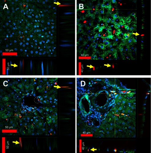 Figure 5 Laser scanning confocal microscopy images of liver section sections (50 µm) obtained from rats treated with FNDP-(NV).Notes: (A) Parenchymal area of liver with indicated cells in yellow circles with up-taken particles. Inserts on the bottom and on the right of the photo represent vertical projection of images performed along the yellow lines. Yellow arrows indicate location of particles. (B) Parenchymal area of liver where yellow circles suggest aggregates of particles within liver sinusoids/venues. Inserts on the bottom and on the right represent vertical projection of images performed along the yellow lines. Yellow arrows indicate particles localized in sinusoids/venules. (C) Area of abundantly vascularized segment of the hepatic lobule where white circles particles suggest sub-endothelial and adventitial location of particles. Parenchymal cells with supposedly internalized particles are indicated in yellow circles. Inserts on the bottom and on the right represent vertical projection of images performed along the yellow lines. Yellow arrows indicate particles internalized in parenchymal cells. (D) Area of the liver hilum where white circles indicate particles associated with adventitial cellular elements. Inserts on the bottom and on the right represent vertical projection of images performed along the yellow lines. Yellow arrows indicate internalized particles into the vascular cells.Abbreviation: FNDP-(NV), fluorescence nanodiamond particles with NV active centers.