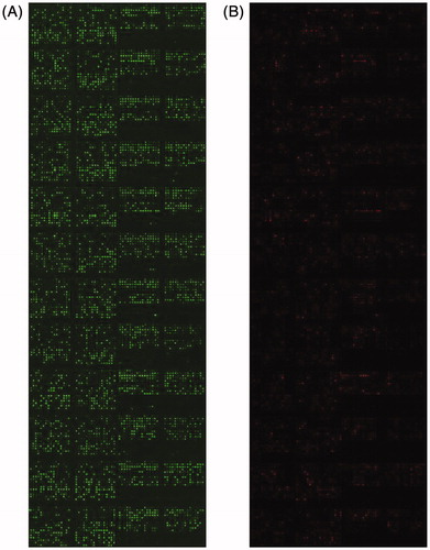 Figure 1. The 2-dye scanning results of expression pattern cDNA microarray in renal tissue of hemorrhagic shock rats with fluid resuscitation. A: Cy3; B: Cy5.