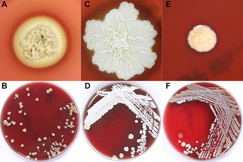 Figure 2 Colony morphology of three Nocardia species after 9 days of Columbia blood agar culture. (A and B), Nocardia otitidiscaviarum; (C and D), Nocardia cyriacigeorgica; (E and F), Nocardia farcinica.