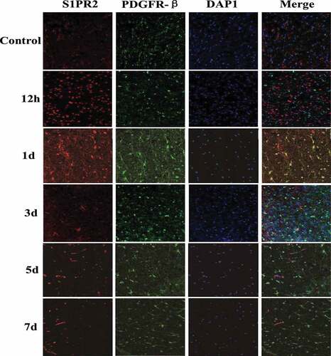 Figure 4. Changes of S1PR2 expression in pericytes of control group and test group at different time points after MCAO modeling