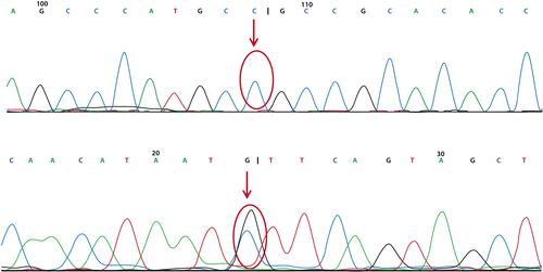 Figure 8 The patient’s mother had genetic mutation in chr18: 211488868 (under red arrow) but no mutation in chr18: 21119839 (upper red arrow).