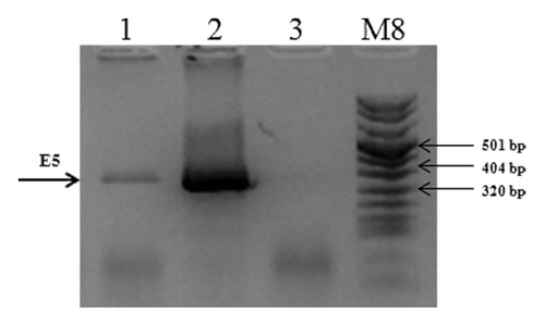 Figure 2. mRNA expression of the E5 gene in C3 cell line. Total cellular RNA was extracted from C3 cell line. cDNAs were synthesized by RT-PCR and specific amplified products were obtained with specific primers as described in “Materials and Methods”. Lane 1, E5 gene amplified from C3 RNA; Lane 2, E5 gene amplified from pCIE5 plasmid, as positive control; Lane 3, total C3 RNA without reverse transcriptase, as negative control; M, molecular weight marker VIII (Roche).