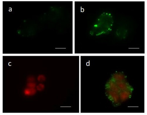 Figure 3. Annexin-V/Propidium Iodide assay in the neuroblastoma SH-SY5Y cells. Panel a) untreated cells; panels b–d) cells treated with DTX. Apoptotic (green, panel b), necrotic (red, panel c), and apoptotic/necrotic cells (green/red, panel d) are shown by Annexin-V/Propidium Iodide assay. Bar 20 μm.