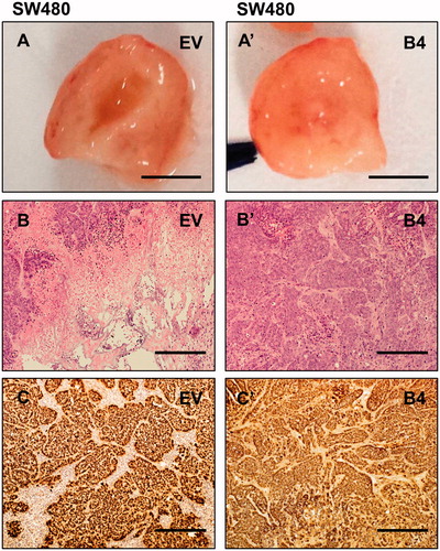 Figure 5. Morphological and histological analysis of SW480 tumors. (A–A’) SW480 subcutaneous tumors dissected in half, revealing tumor centers (Scale bar = 2mm). (B–B’) Heamotoxylin and eosin stained SW480 EV, B4 tumors (Scale bar =100 µm). (C–C’) Immunohistochemical labeling of SW480 EV and B4 tumors using anti-human antibody (Scale bar =100 µm).