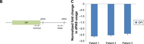 Figure 5 GPI preferentially use proximal APA in cancer samples.
