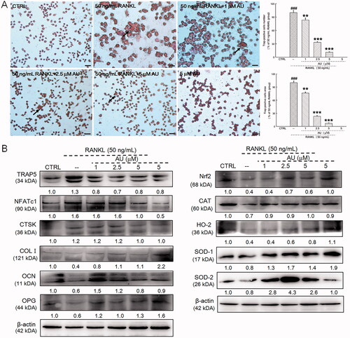 Figure 7. AU suppressed the receptor activator of nuclear factor-κB ligand (RANKL)-induced differentiation of RAW264.7 cells to osteoclasts. (A) AU decreased the percentage of numbers and area of TRAP-positive RANKL-exposed RAW264.7 cells (200×) (Scale Bar: 50 μm). Data are expressed as the means ± SEMs (n = 6) and were analysed using a one-way ANOVA. ###p < 0.001 versus control cells; **p < 0.01 and ***p < 0.001 versus RANKL-induced differentiated cells. (B) In RANKL-exposed RAW264.7 cells, AU increased the expression levels of COL I, OCN, OPG, Nrf2, CAT, HO-2, SOD-1 and SOD-2, and decreased the expression levels of TRAP5, NFATc1 and CTSK. The quantitative expression of each protein was normalised to β-actin and is presented as the fold-expression compared with the expression in control cells (n = 6). CTRL: control; AU: aucubin.