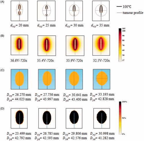 Figure 5. Computer simulation results for the TTN of target tissues of different sizes at the MVA (A) 100 °C isotherm, (B) temperature distribution (in °C), (C) tissue death (IT50) and (D) tissue death rate (%) (D63).