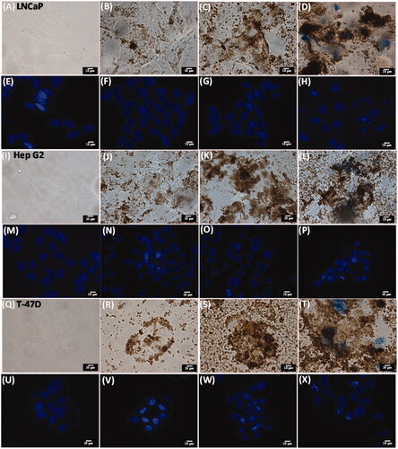Figure 4. Bright field microscopic images obtained by treating LNCaP (A–H), Hep G2 (I–P), T-47D (Q–X) with media only (A, I and Q), Fe3O4 MNPs (∼4 mg mL−1) (B, J and R), Fe3O4@RFMP MNPs (∼4 mg mL−1) (C, K and S) and BP-Fe3O4@RFMP MNPs (∼4 mg mL−1) (D, L and T) for 4 h followed by culturing another 68 h after renewing the media, then rinsed with aqueous NaCl (0.9%,1 mL ×3) and stained with Trypan blue and Hoechst 33342 dye before observation under microscopy. Panels (E)–(H), (M)–(P) and (U)–(X) were the corresponding images obtained under fluorescence microscopy. The scale bar is 10 μm. The exposure time was 6 ms.