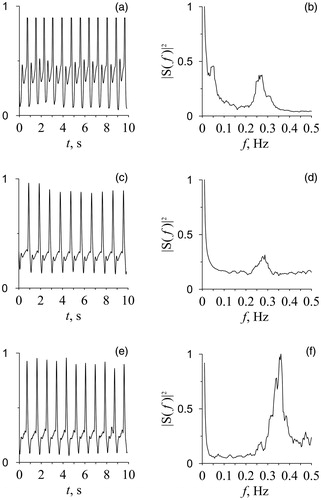 Figure 1. Examples of photoplethysmographic signals (a, c, e) and their spectrums (b, d, f) in healthy subjects (a, b), hypertensive patients (c, d), and patients with coronary artery disease (e, f).