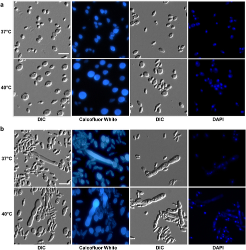 Fig. 4 Morphologies of C. auris cells grown on YPD (a) and YPD plus 10% NaCl (b) media.Cells (1 × 105) were spotted onto different medias and cultured at 37 °C and 40 °C for five days. Cells were collected and stained with DAPI or Calcofluor white. Scale bar, 10 μm. DIC, differential interference contrast