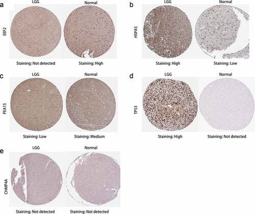 Figure 10. Immunohistochemistry of prognostic signature-related genes in patients with and without in low-grade glioma (LGG). (a-e) EEF2, HSPA5, PEA15, TP53, and CHMP4A, respectively