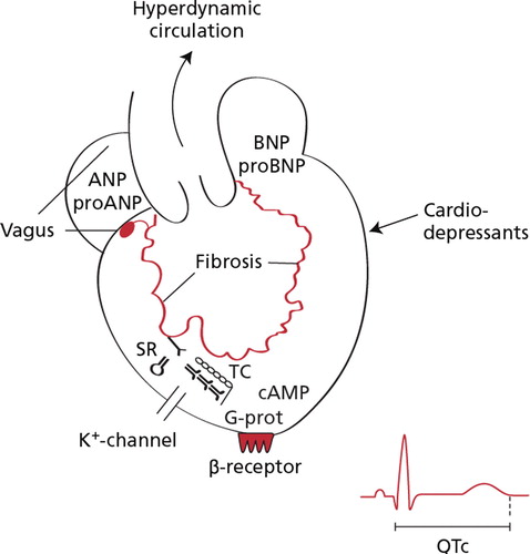 Figure 3.  Potential pathophysiological mechanism involved in the development of cirrhotic cardiomyopathy. Abbreviations: cAMP: cyclic adenosine monophosphate; pro-ANP: N-terminal propeptide of atrial natriuretic peptide; pro-BNP: pro-brain natriuretic peptide: N-terminal propeptide of brain natriuretic peptide, QTc: frequency adjusted Q-T interval; SR: sacroplasmic reticulum; TC: cardiac troponin C; G-prot: signal protein of G-type.