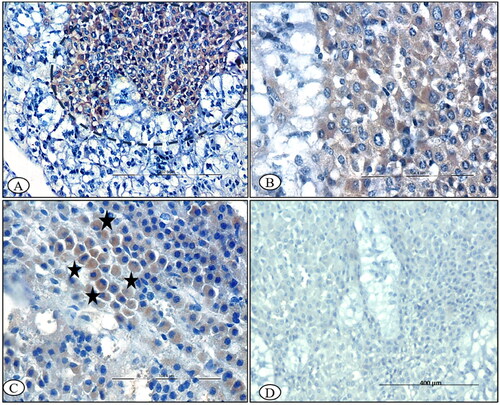 Figure 10. BTV-1 infected sheep at 60th DPI, ABC-IHC-DAB, immunohistochemically stained section, polyclonal caspase-3 primary antibody. (A) Adrenal gland showing the positive immunostaining for anti caspase-3 in the cytoplasm of the cell of zona reticularis cells (circle), ×200. (B) Higher magnification, ×400. (C) Positive immunolabeling in the cytoplasm of zona fasciculata cells (asterisk) that arranged in the linear manner, ×400, 30th DPI. (D) No signals were detected in the control group adrenal sections, 30th DPI, DAB-IHC, ×100.