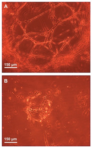 Figure 11 Phase-contrast microscope images illustrating the three-dimensional growth, proliferation, and differentiation of the NOM cells in the magnetic fibrin hydrogel scaffolds 21 days postcultivation in the presence (A) and absence (B) of the bFGF-γ-Fe2O3 nanoparticles.Abbreviations: bFGF, basal fibroblast growth factor; NOM, nasal olfactory mucosa.