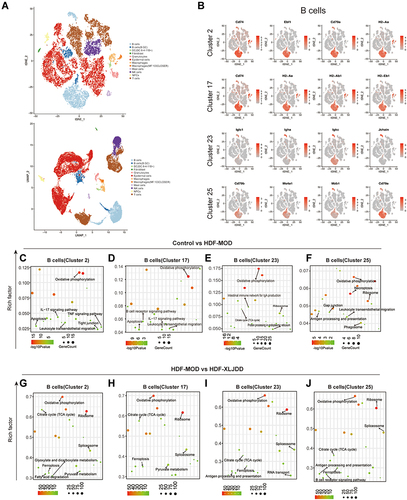 Figure 7 Identification of B cells clusters by Single-cell Atlas. (A) The t-SNE plot and UMAP plot showed the predicted type of cells. (B) The t-SNE plot of cluster with marker genes expression, the red dots represent the cells with high expression of the marker gene in the total detected cells. (C–F) The enrichment analysis of differential genes in B cells (cluster 2, cluster 17, cluster 23, cluster 25) between control and HDF-MOD groups. (G–J) The enrichment analysis of differential genes in B cells (cluster 2, cluster 17, cluster 23, cluster 25) between HDF-MOD and HDF-XLJDD groups.