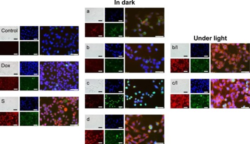 Figure 7 Living cell fluorescence imaging.Notes: Nuclei (blue) localization (Hoechst 33258), Dox fluorescence (red) and formation of redox stress (green) in LNCaP cells exposed to 34 μM of free Dox, freshly prepared ApoDox in PBS (S), and ApoDox prepared in PBS and stored at 20°C (a), 4°C (storage in dark [b] and storage under direct ambient light [b/l]), 20°C (storage in dark [c] and storage under direct ambient light [c/l]), and 37°C (d). Merged figures show the colocalization of blue, red, and green fluorescence. The length of scale bars is 100 μm.Abbreviations: Dox, doxorubicin; Apo, apoferritin; PBS, phosphate-buffered saline.