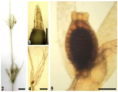 Figure (2–5). Some diagnostic characteristics of freshly sampled material of Chara vulgaris Linn. in this study. Scale bar = 1 cm (Fig. 2); scale bar = 100 μm (Fig. 3); scale bar = 1 mm (Fig. 4); scale bar = 200 μm (Fig. 5). (2) Macroscopic habitus of thallus showing long internodes. (3) Terminal branchlet cell. (4) Overview of branchlet node showing four well-developed bracteoles clearly much longer than oogonium. (5) Branchlet node with solitary dark-brown mature oogonium and absence of antheridium.
