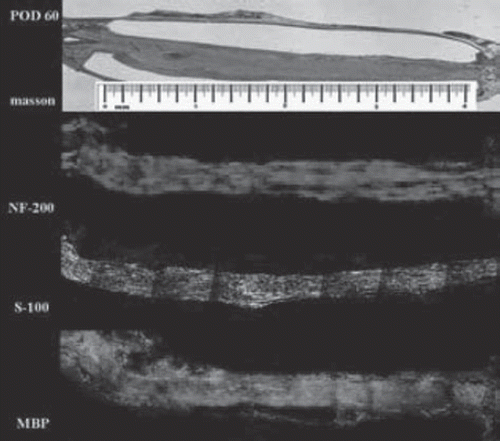 Figure 7. Histological examination on day 60 after surgery. Nerve fibers manifest a more mature morphology (scale range is 4 mm, n=3).