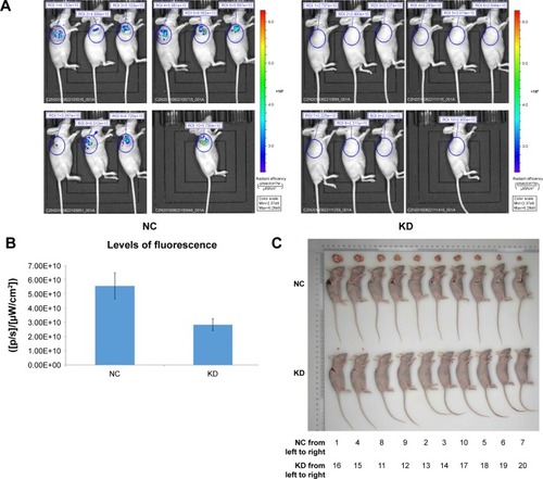 Figure 6 The effect of Syt-7 knockdown on tumor progression in vivo. (A) Fluorescence images of mice models. (B) The levels of fluorescent expression in shSyt-7 group were significantly decreased than that in control group (2.83×1,010±4.29×109 vs 5.55×1,010±9.07×109, P<0.05). (C) The subcutaneous xenograft mice models and representative images of tumors in mice in models. (D) Changes in the tumor volume (2.61±7.71 vs 823.55±401.62, P<0.05). (E) Changes in the tumor weight (0.005±0.011 vs 0.830±0.396, P<0.05).
