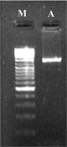 Figure 2 Electrophoresis of the extracted genomic DNA in a 1% agarose gel.Notes: (A) 16S rDNA amplified by PCR from genomic DNA of Nostoc. (M) Molecular marker 1500 bp.Abbreviation: PCR, polymerase chain reaction.